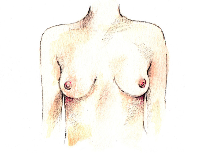 Cicatriu RECONSTRUCCIÓN