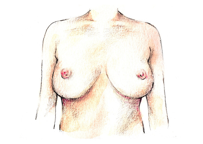 RECONSTRUCCIÓN mugró